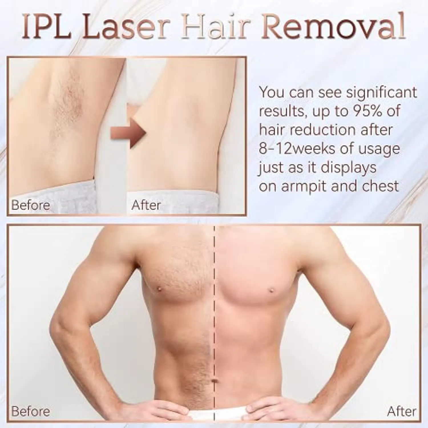 Hair Removal, Laser Permanent Hair Removal for Women and Men, 999900 Flashes UPGRADED At-Home Hair Removal Device for Facial Legs Arms Whole Body Treatment